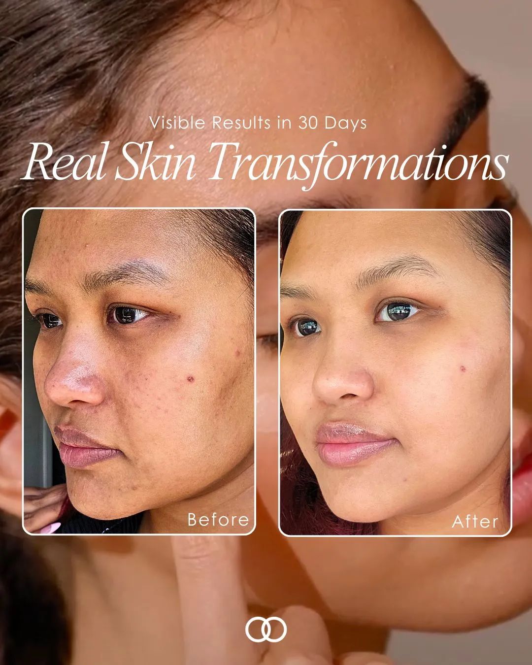 Phức hợp Retinol 8% của SRX có gì đặc biệt?